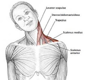 Dor de cabeça cervical
