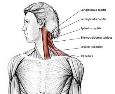 Dor de cabeça cervical