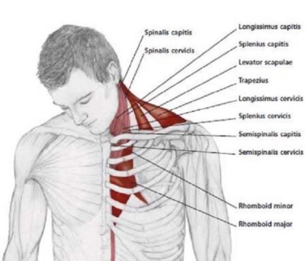 Dor de cabeça cervical